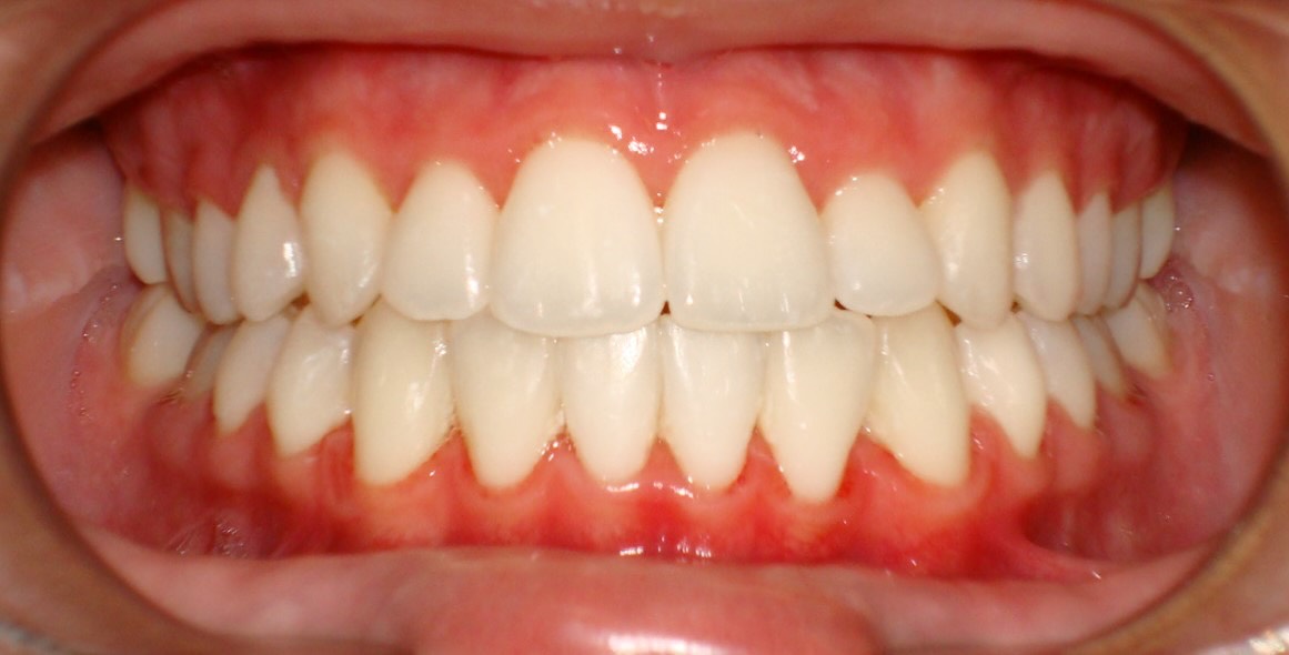 Ορθοδοντική