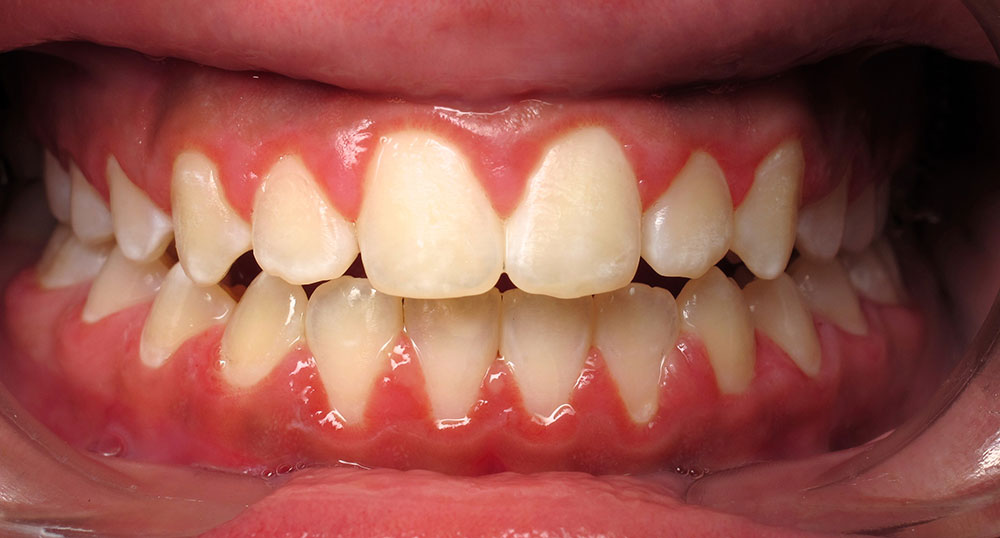 Ορθοδοντική