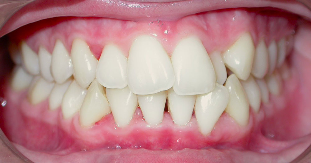 Ορθοδοντική